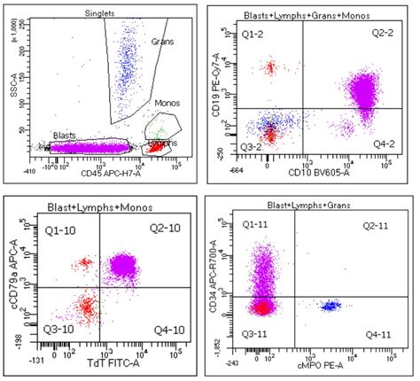 flow cytometry leukemia/lymphoma panel results